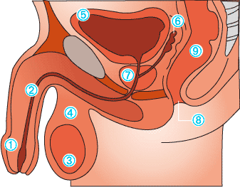 adenom prostate)