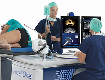 prostate hifu focal focused ultrasound